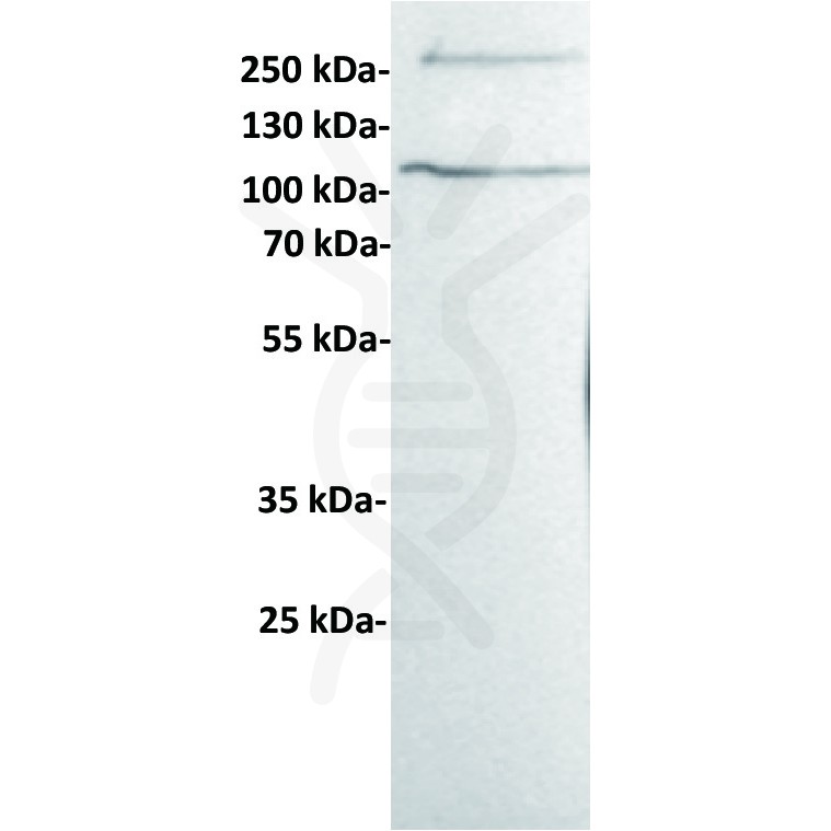 antibody-dme100433 her3 wb1