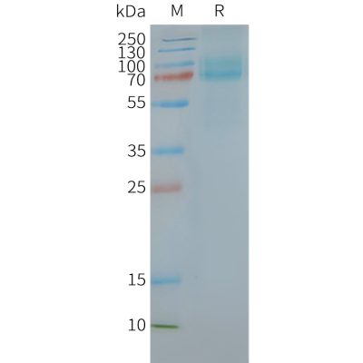 page-FLP100052 FZD10 Fig.2 SDS PAGE 1