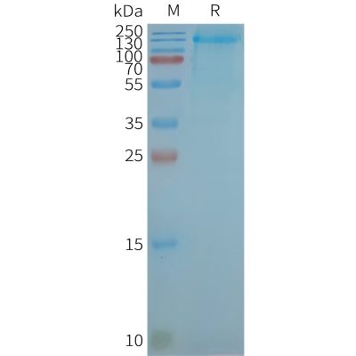 page-FLP100072 LGR4 Fig.2 SDS PAGE 1
