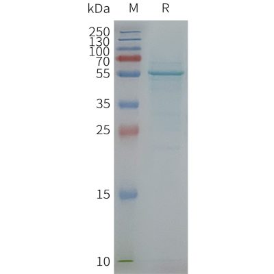 page-FLP100101 TMCC3 Fig.2 SDS PAGE 1