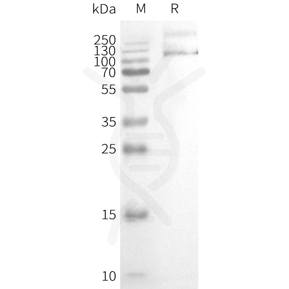 page-FLP100128 TRPV1 Fig.2 SDS PAGE 1