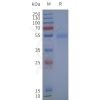 page-flp120240 fpr2 strep sp1