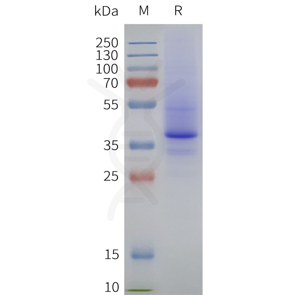 page-flp120335 lpar2 strep sp1