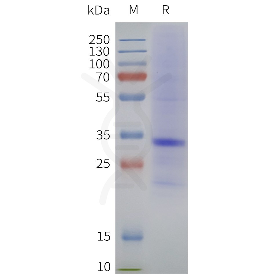 page-flp120354 mc1r strep sp1