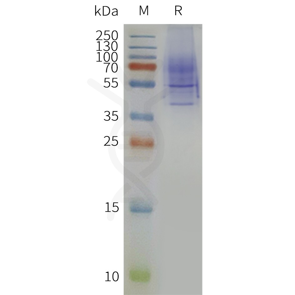 page-flp120361 nk3r strep sp1