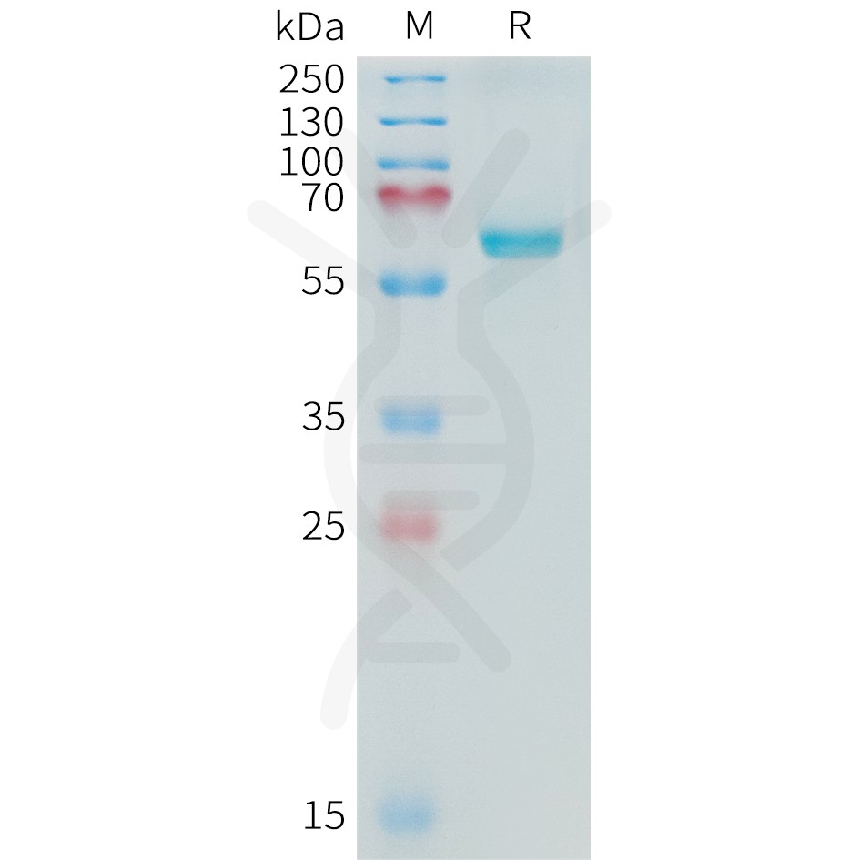 sp-PME C100017 ALPP Fig.1 SDS PAGE 1