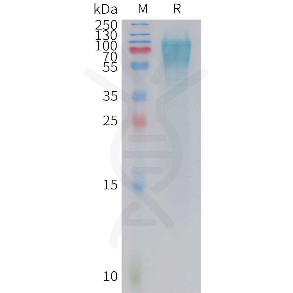 sp-PME C100022 GUCY2C Fig.1 SDS PAGE 1