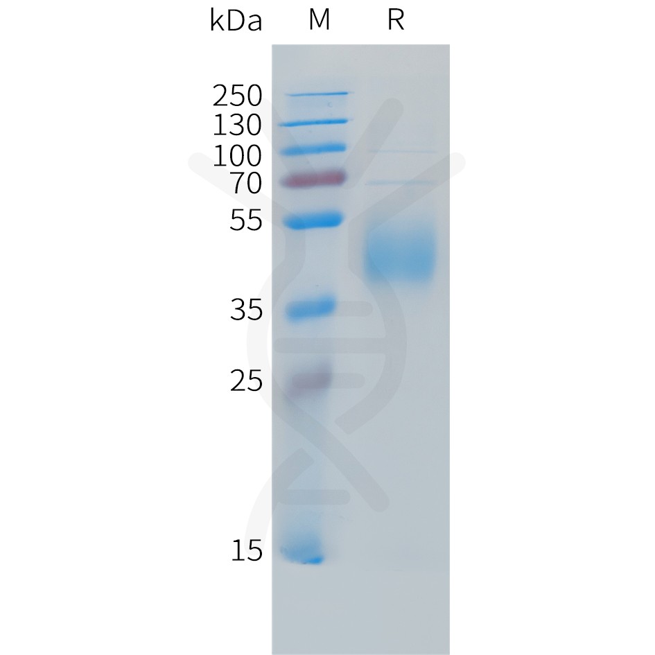 sp-PME C100031 B7 H6 Fig.1 SDS PAGE 1