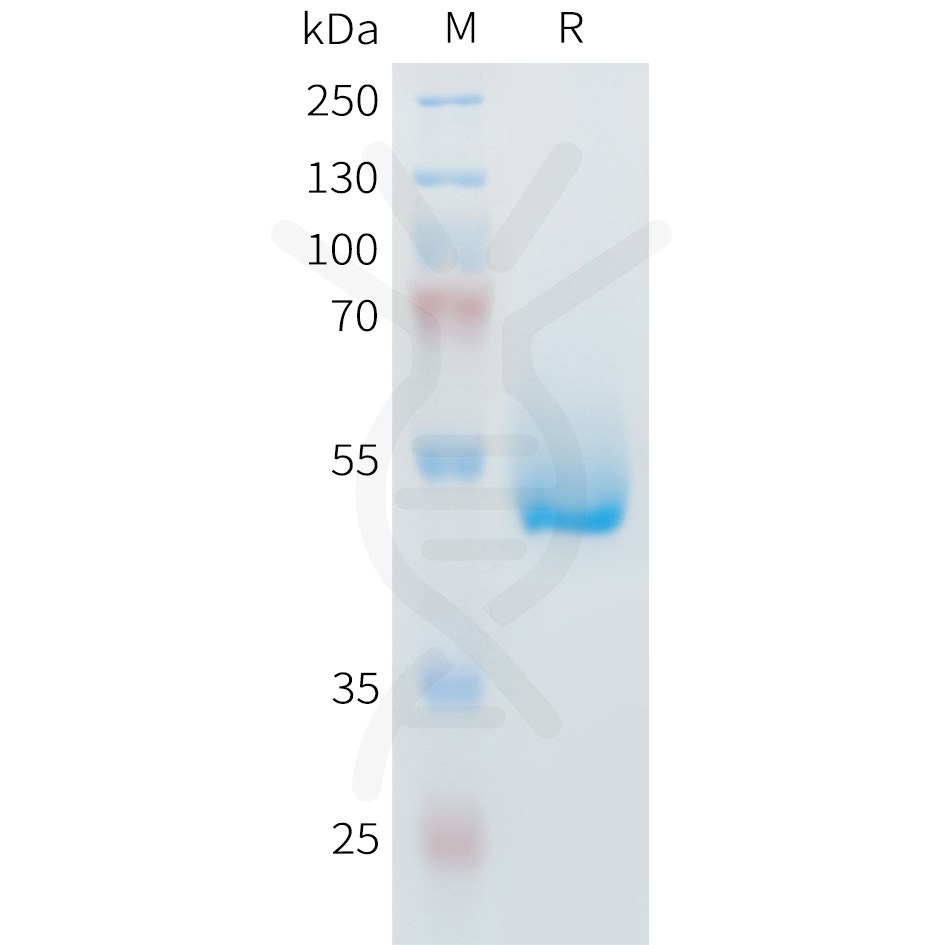 sp-PME M100100 IL6 Fig.1 SDS PAGE 1