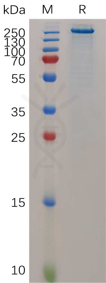 sp-PME100685 TENM4 His PAGE 300