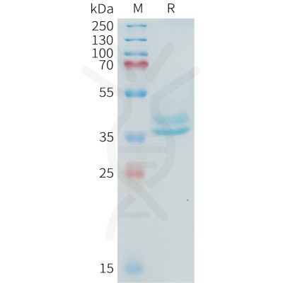 sp-PME101098 ADAM17 Fig.1 SDS PAGE 1