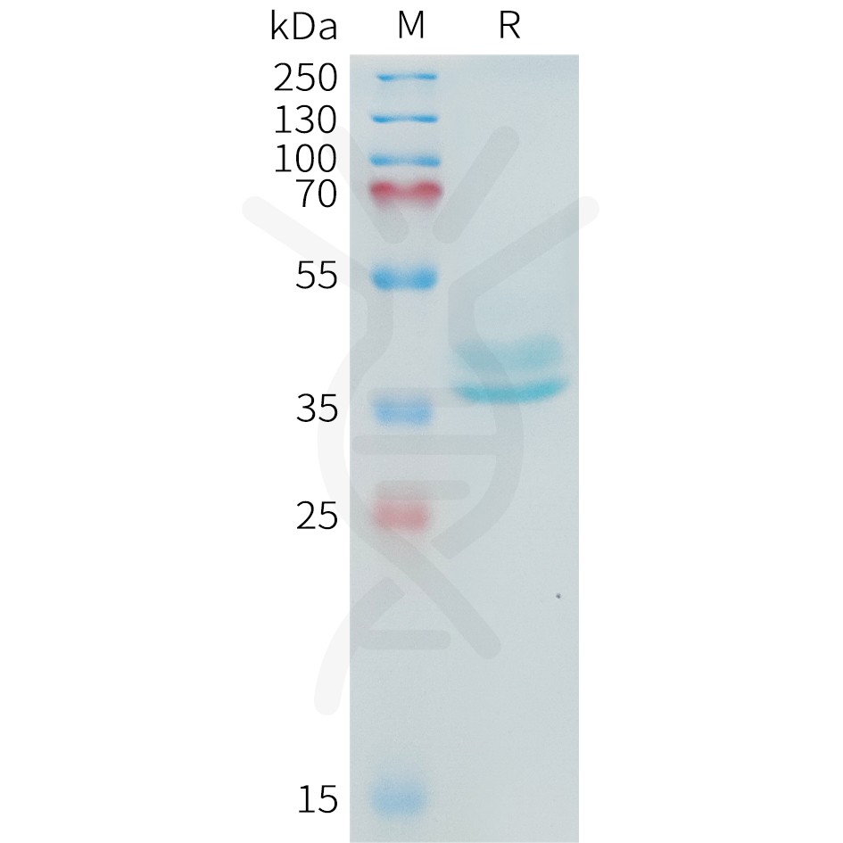 sp-PME101098 ADAM17 Fig.1 SDS PAGE 1