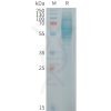 sp-PME101254 IL23R Fig.1 SDS PAGE 1