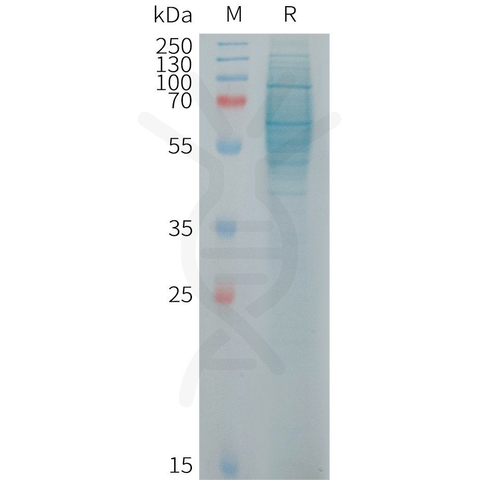 sp-PME101254 IL23R Fig.1 SDS PAGE 1