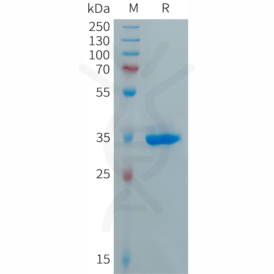 sp-PME101288 CXCL5 Fig.1 SDS PAGE 1