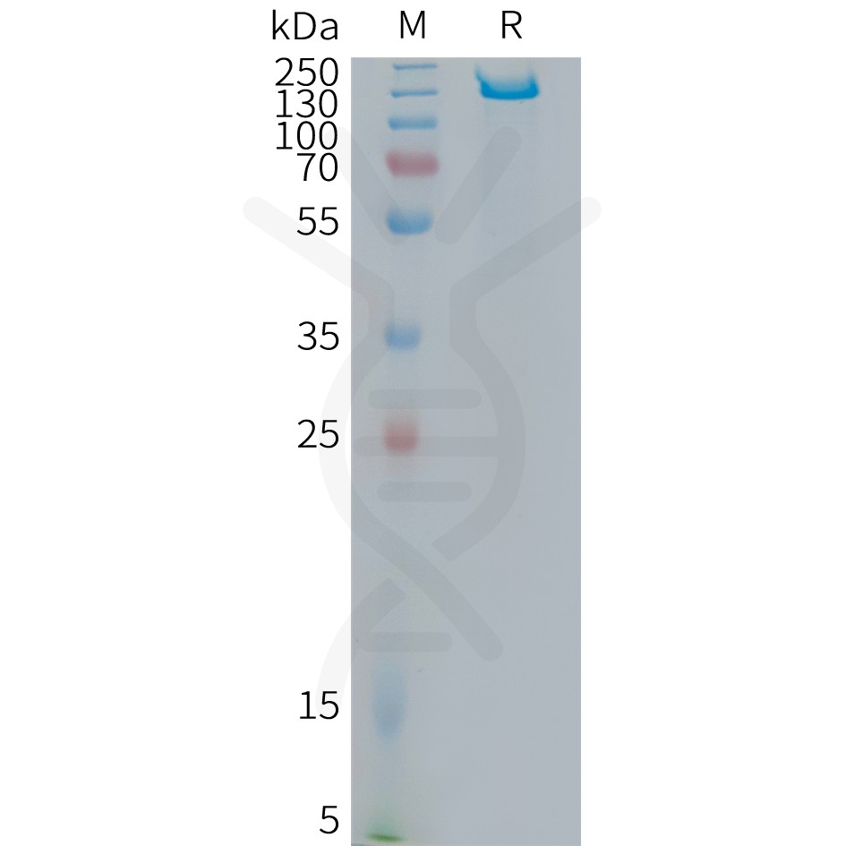 sp-PME101378 ITGB6 Fig.1 SDS PAGE 1