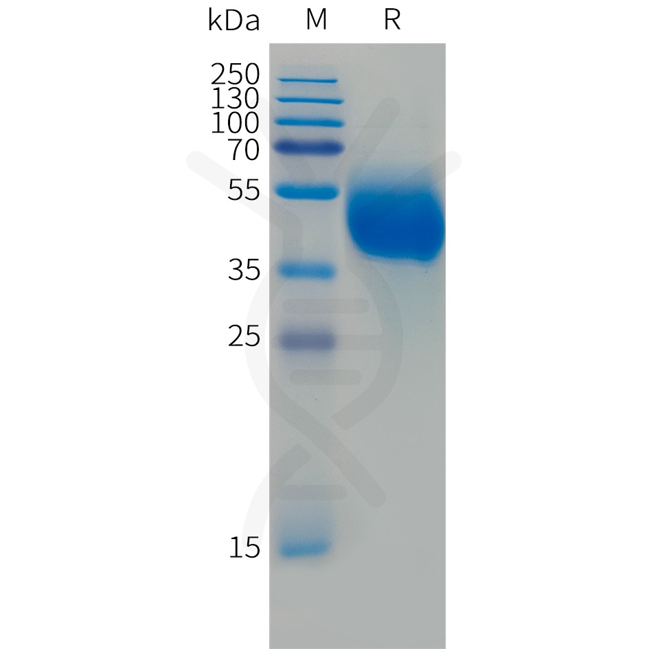 sp-PME101493 FCRL5 Fig.1 SDS PAGE 1