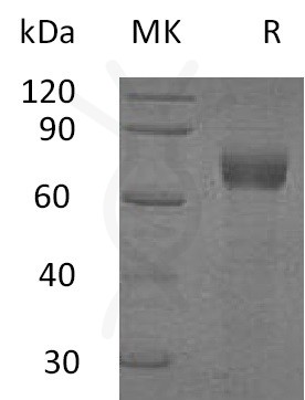 sp-PME30049 CB04 Q9UHF4 SDS PAGE 0