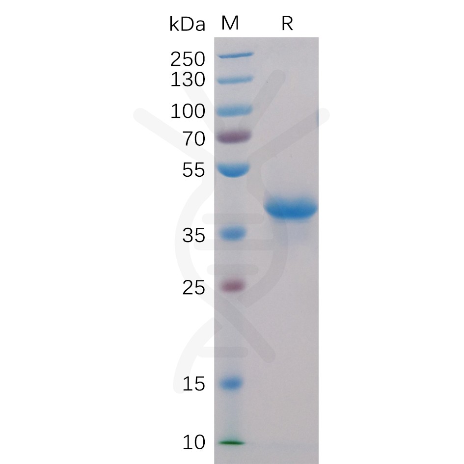 sp-pme100001 bcma sp1