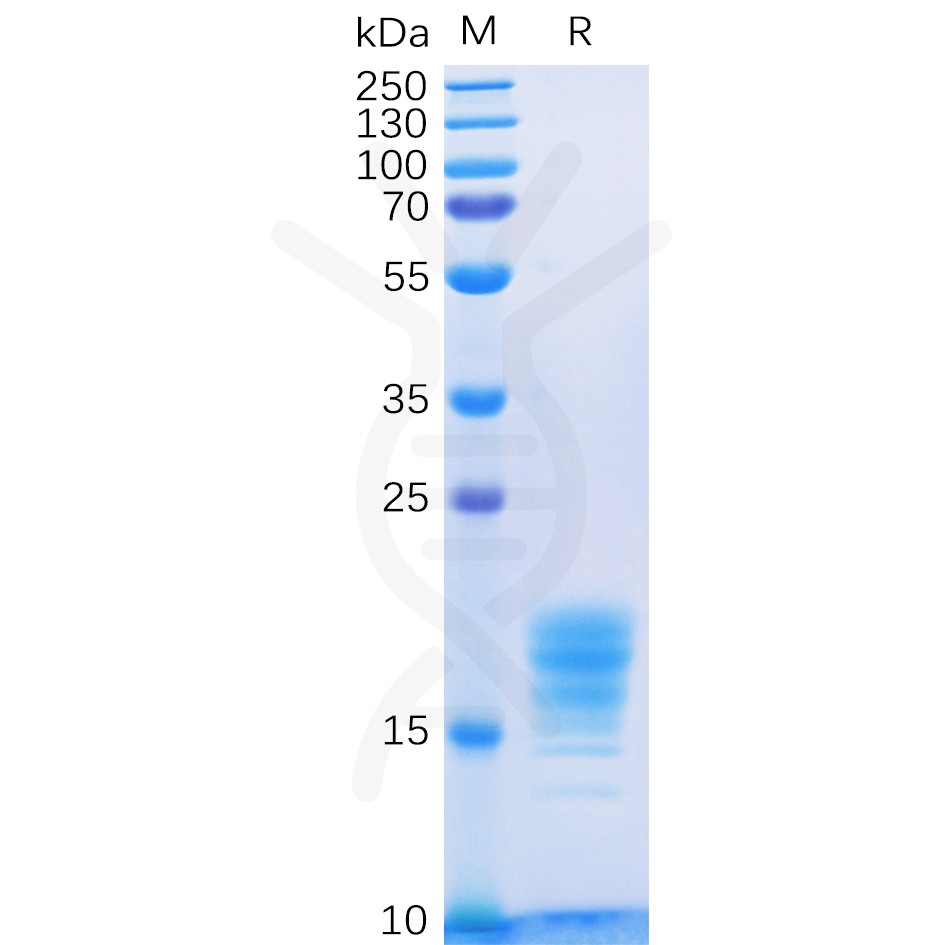 sp-pme100085 il5 sp1