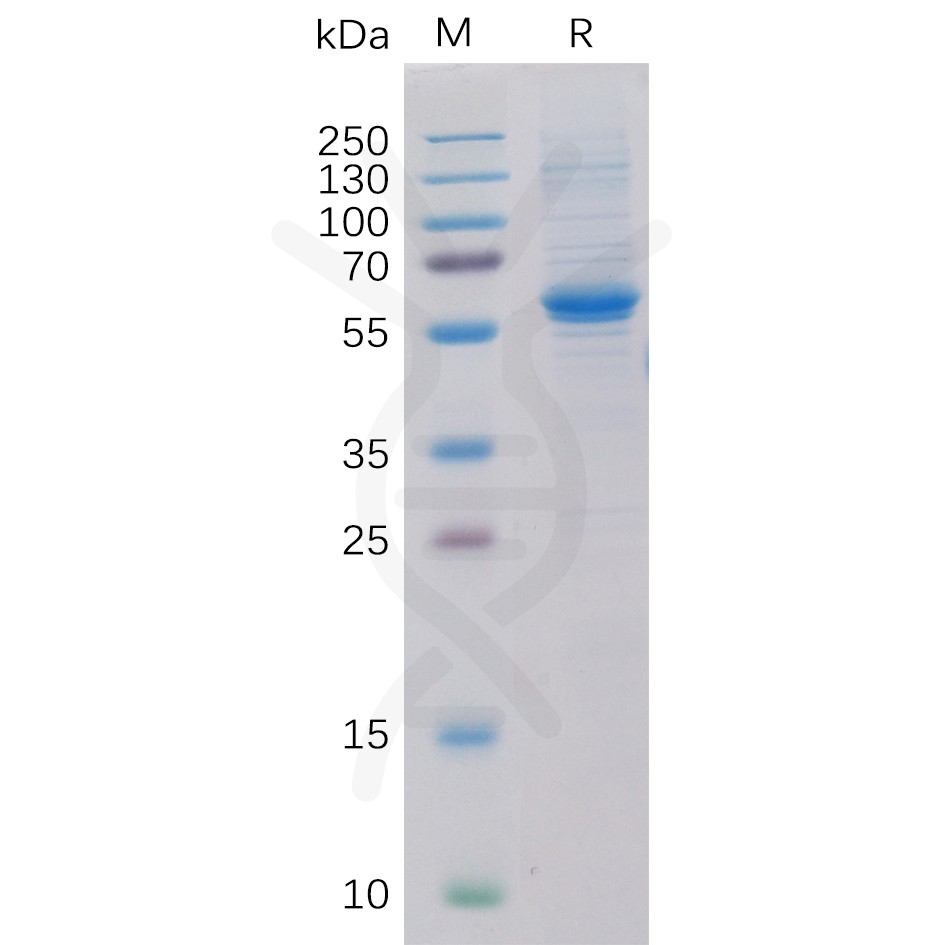 sp-pme100097 ror2 sp1