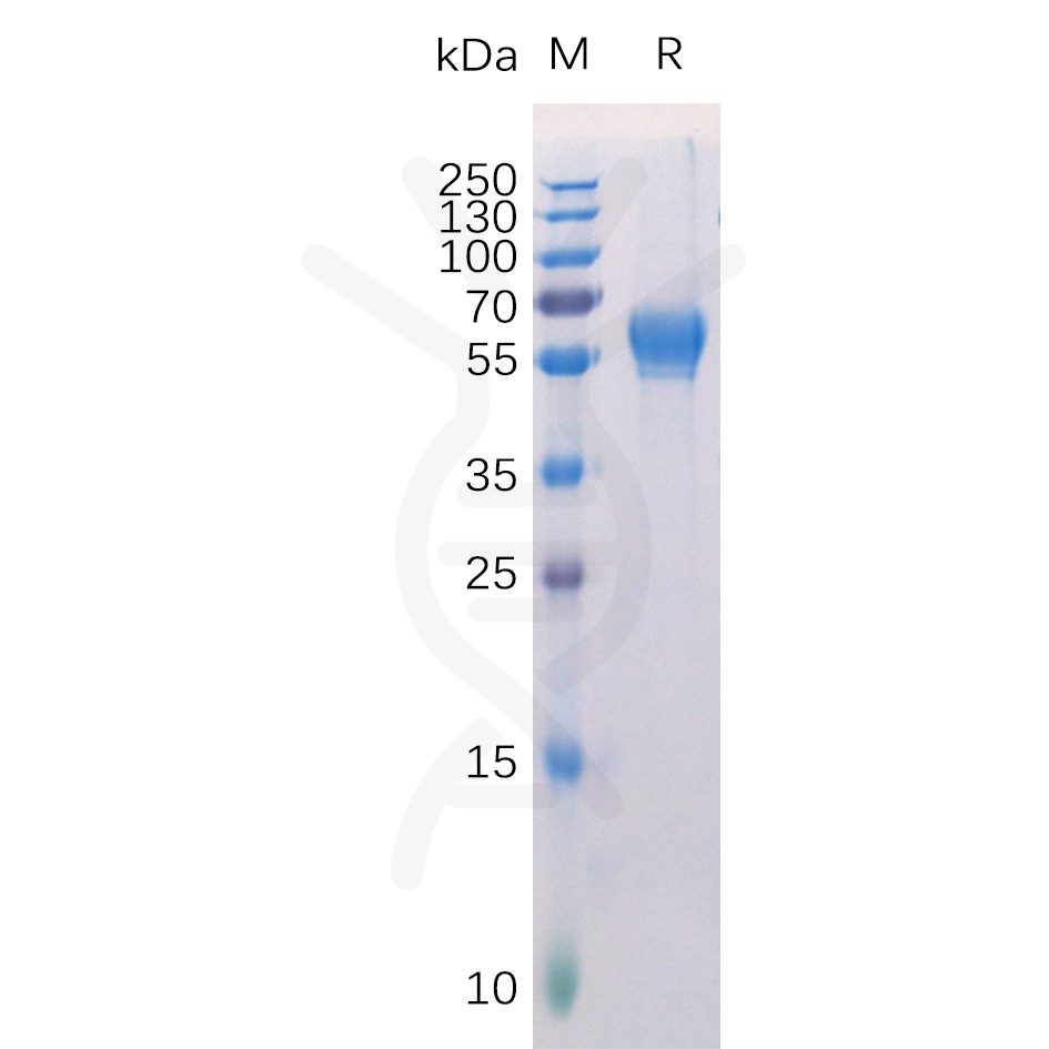 sp-pme100399 ror1 sp1