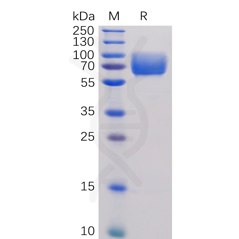 sp-pme100474 b7 2 sp1