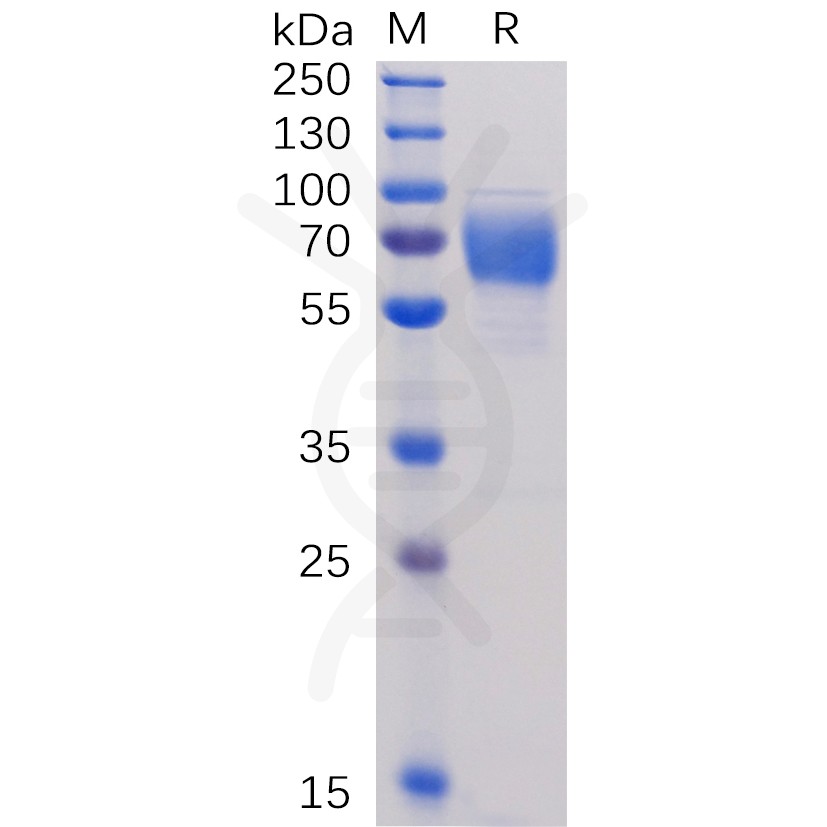 sp-pme100477 2b4 sp1