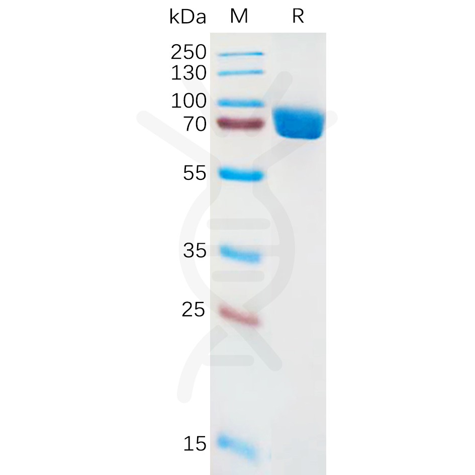 sp-pme100886 il1ra sp1