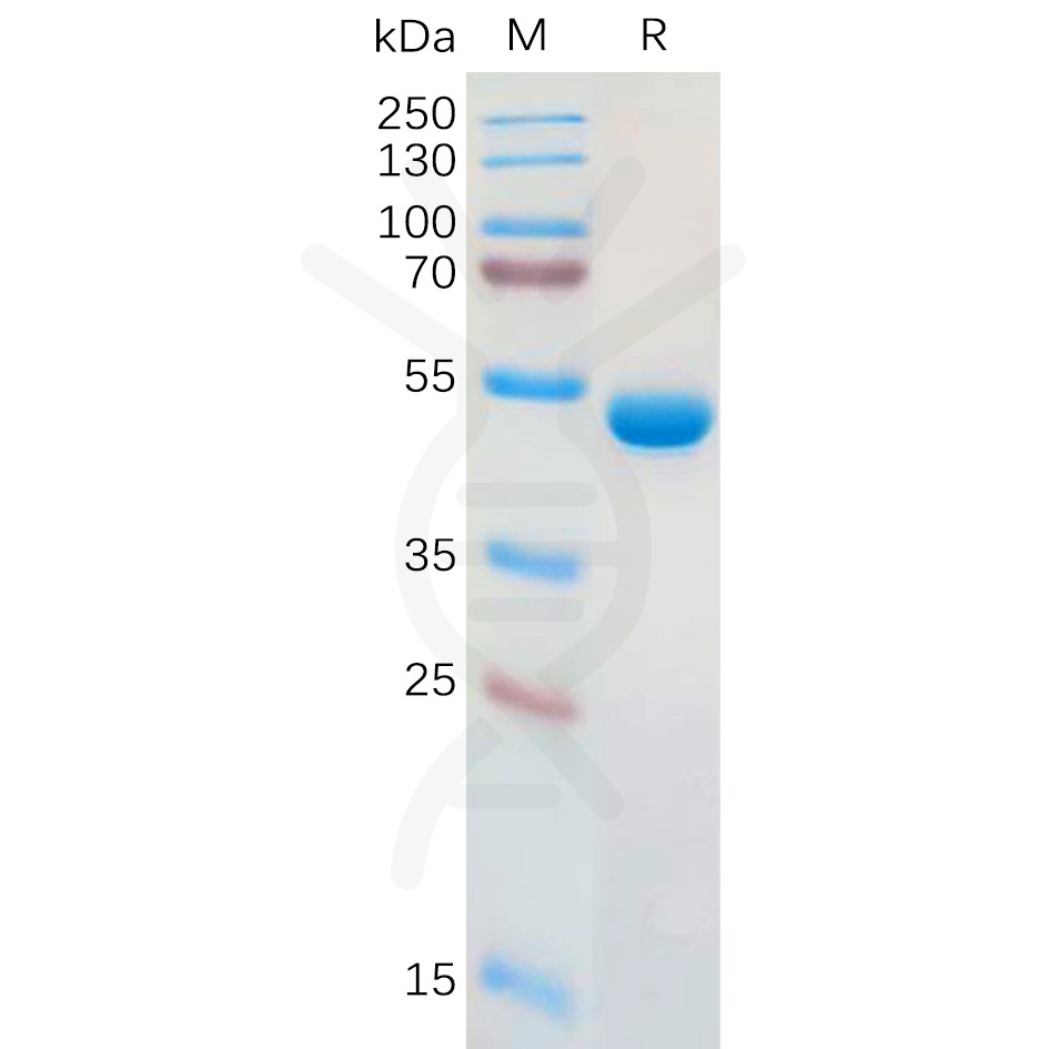 sp-pme100952 lgals1 sp1