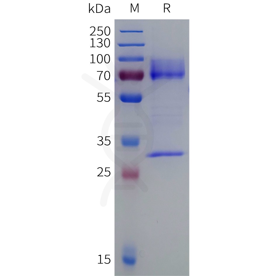 sp-pme101016 tgfb3 sp1