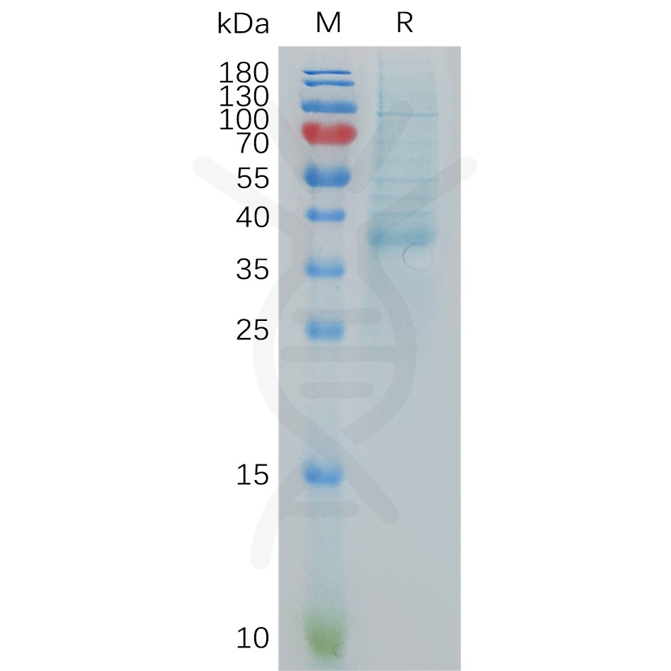 sp-pme101060 cxcl13 sp1