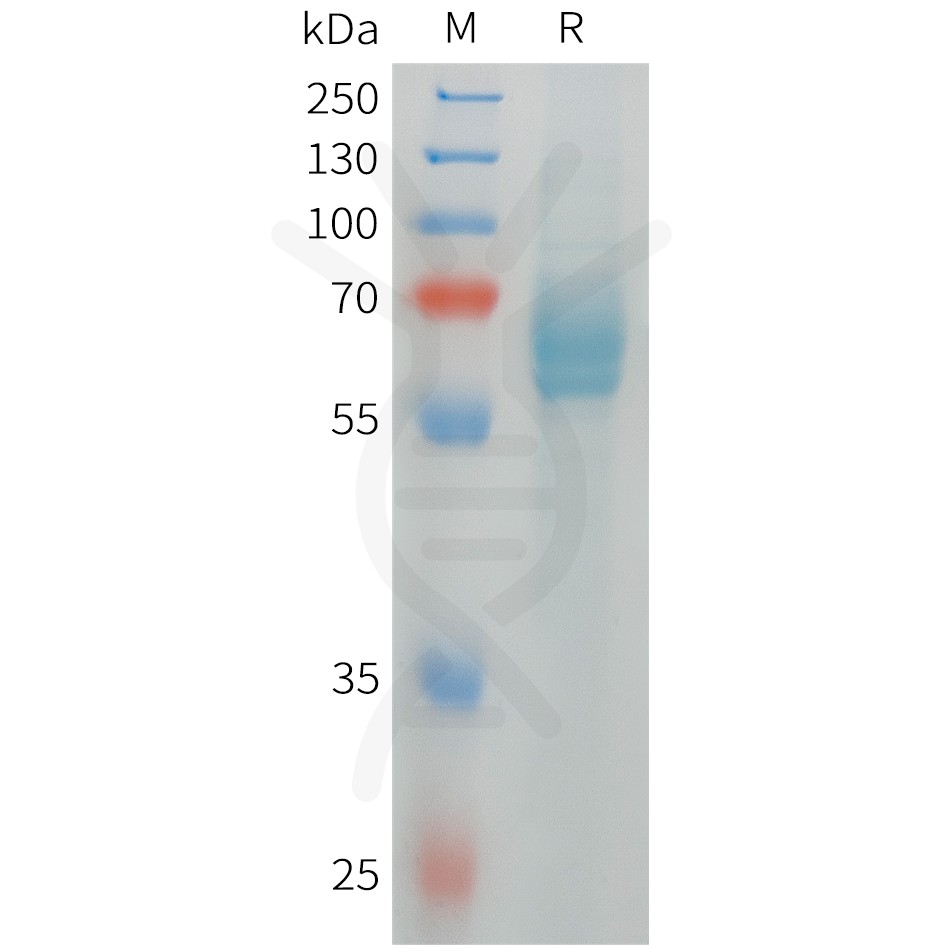 sp-pme101473 dll4 sp1