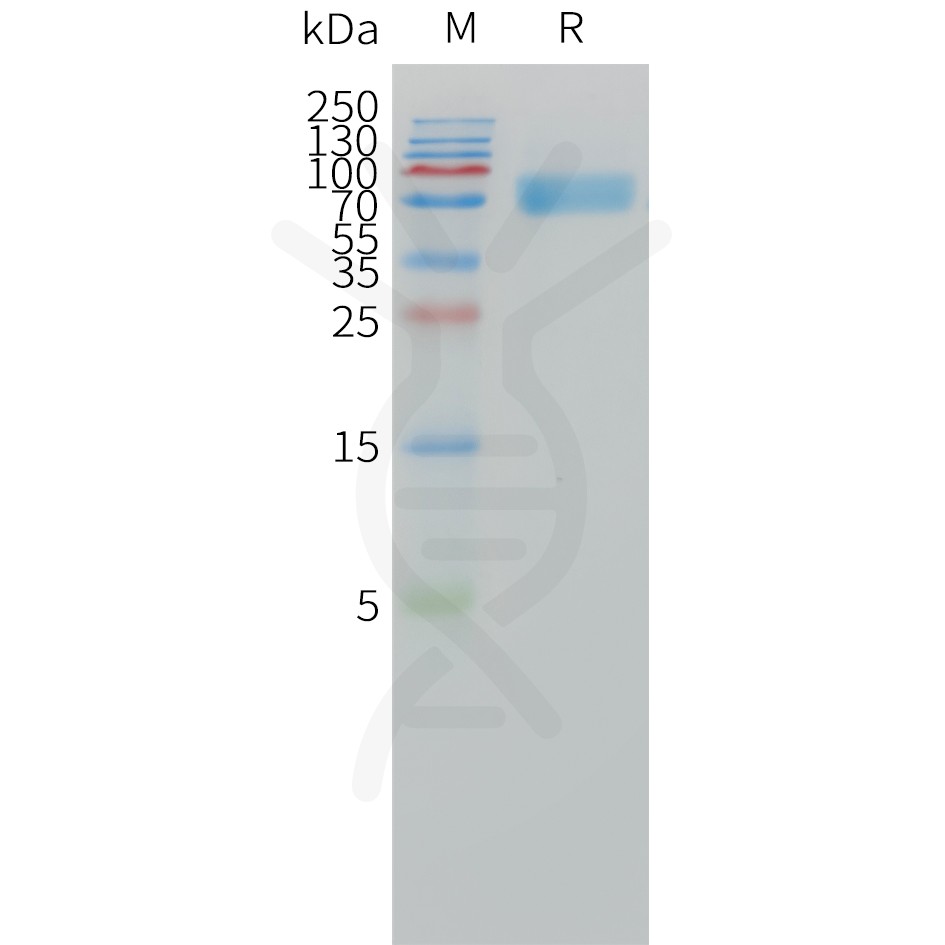 sp-pme101502 il1ra sp1