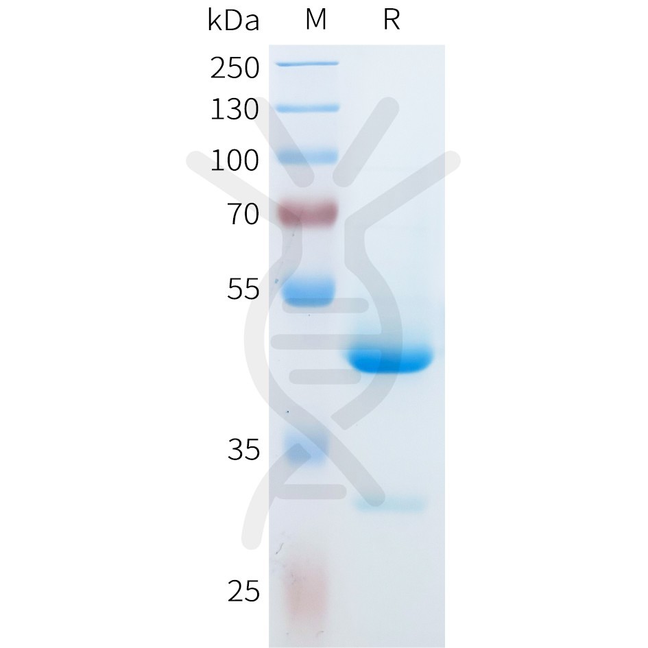 sp-pme101580 il36g sp1