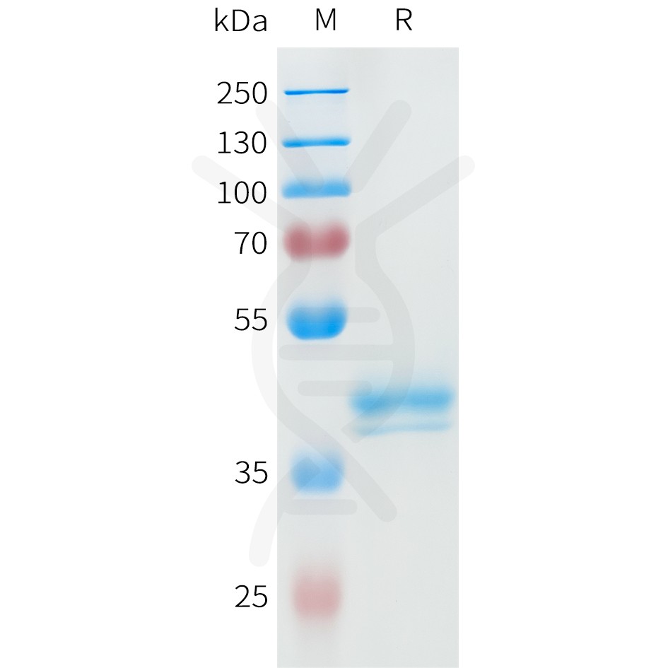 sp-pme101595 ror2 sp1