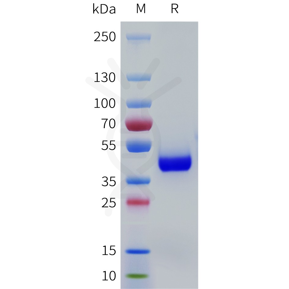 sp-pme101778 or1e1 sp1