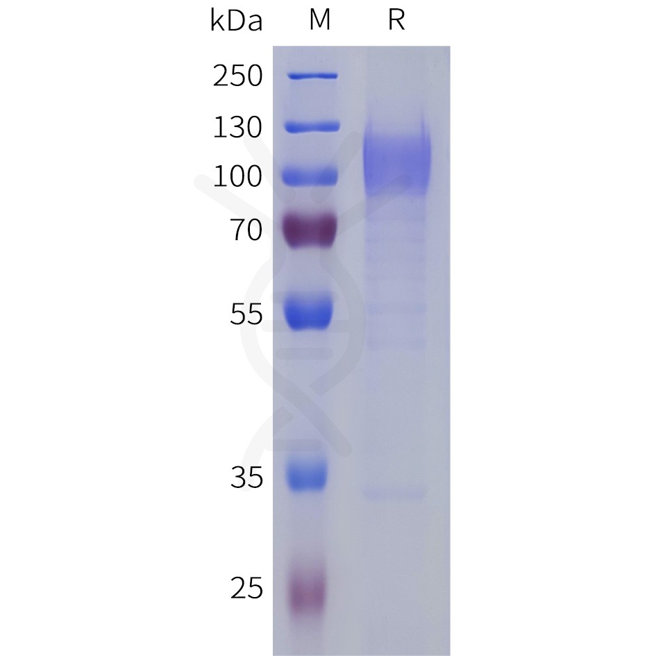 sp-pme101804 lrrc4 sp1