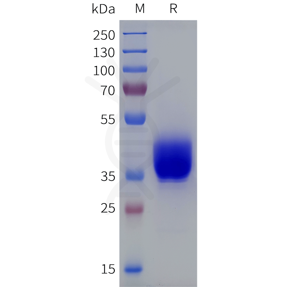 sp-pme101856 lpar2 sp1
