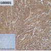 ihc-sli100001 rpmi 8226 ihc1
