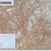 ihc-sli100006 mkn45 ihc1