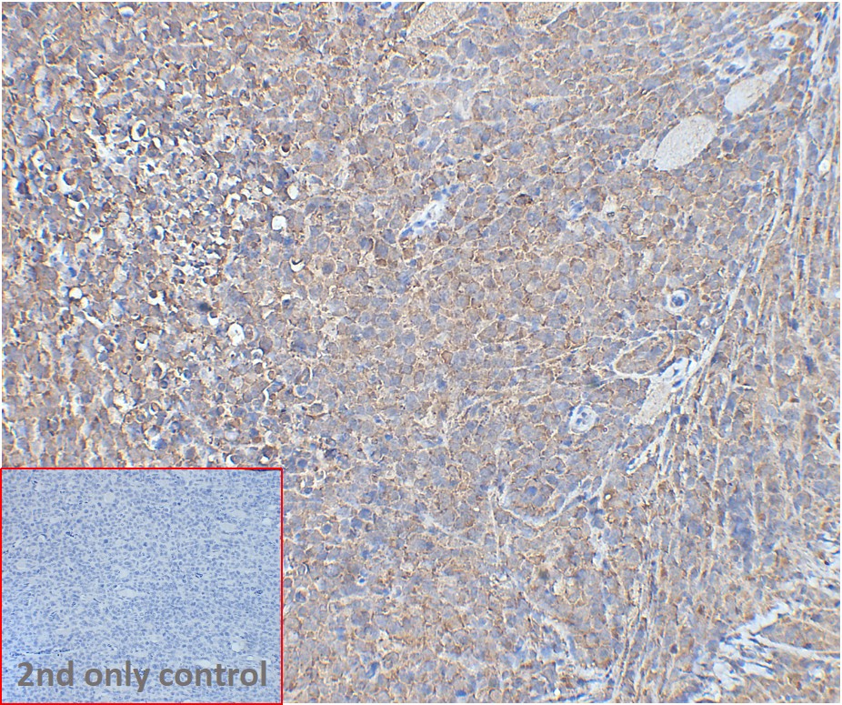 ihc-sli100013 raji ihc1