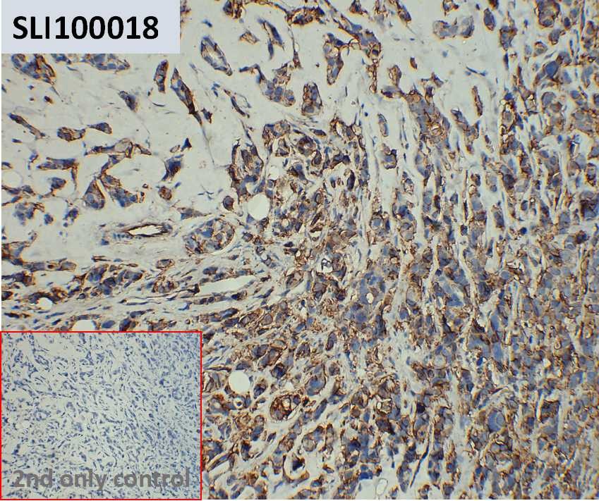 ihc-sli100018 mcf 7 ihc1